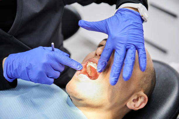 Best Knocked-Out Tooth (Avulsed Tooth) Treatment in Celebration, FL
